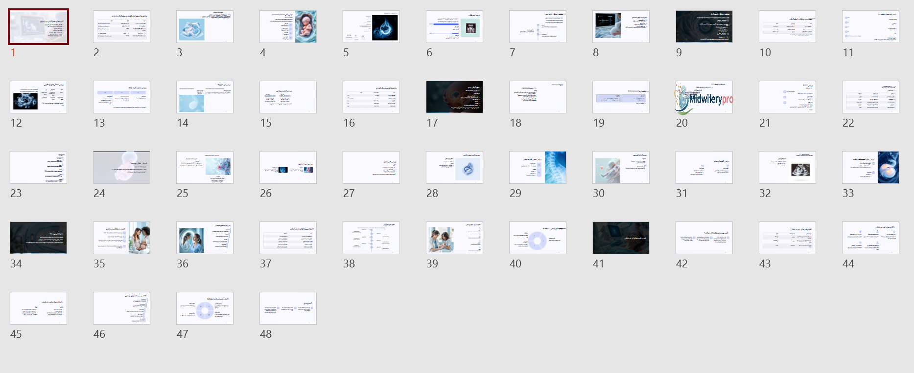 سونوگرافی در بارداری